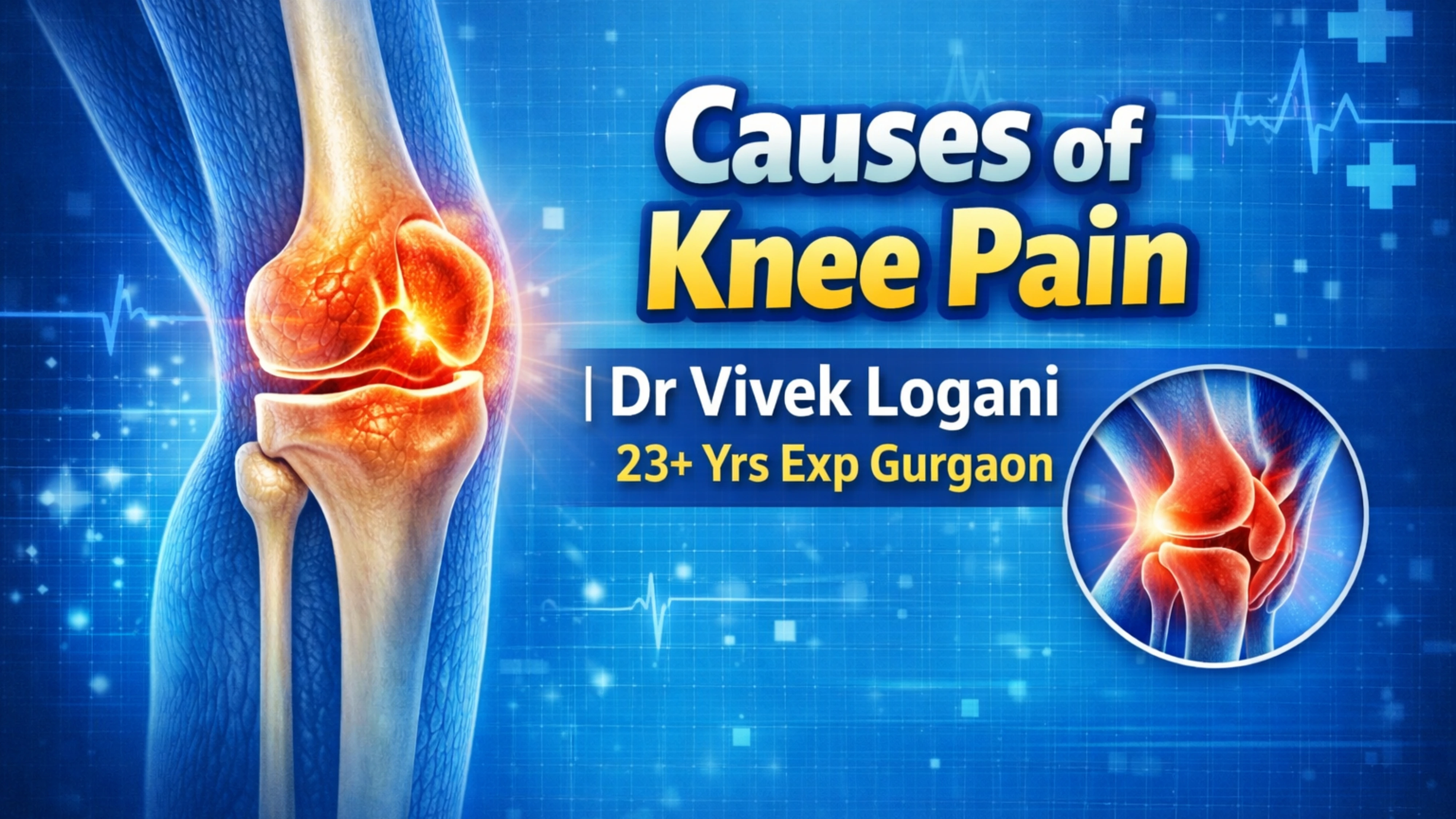 Causes of Knee Pain 